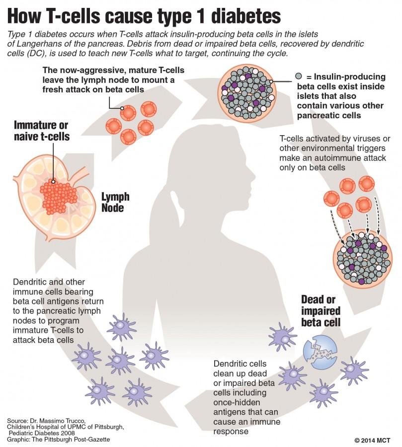 Type 1 diabetes, which is usually diagnosed in children and young adults, currently has no cure (Graphic Credit: MCT Wire Service). 
